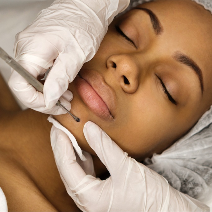 Clear Skin Facial at Skin Boutique North Carolina in Mooresville, NC