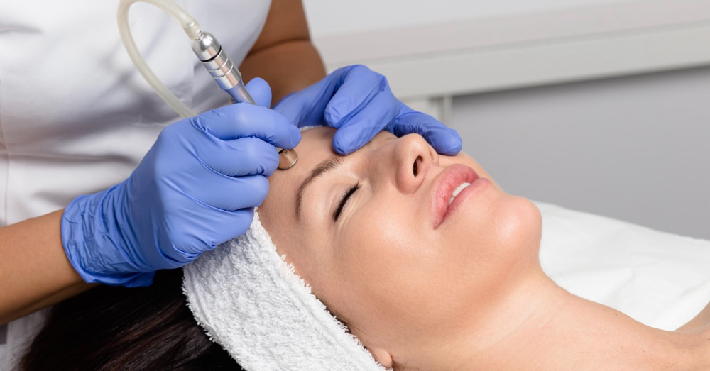 Microdermabrasion