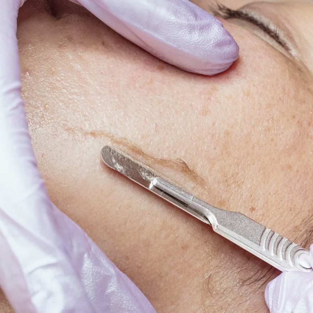 Dermaplaning at The Blonde Beautician in Starke, FL