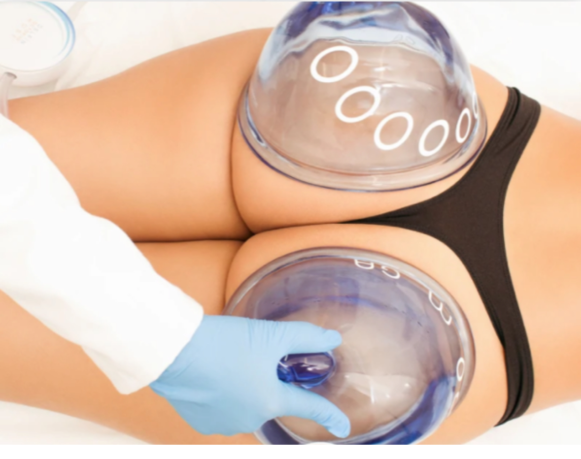 VacuumButtLift & CelluliteTreatment