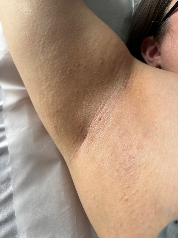 Underarm Wax