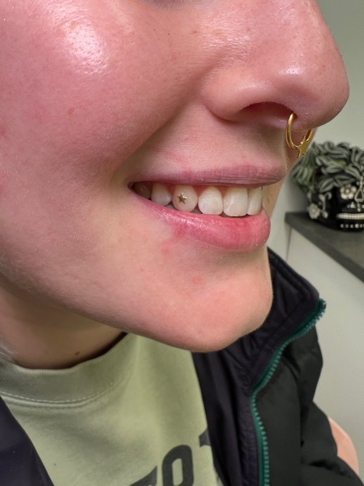 Gold Tooth Gem