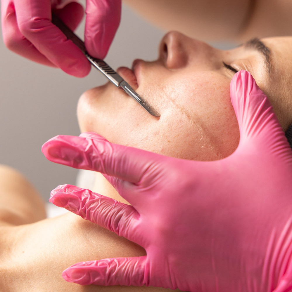 Dermaplaning at OhMyGlow Beauty Esthetics in Fort Lupton, CO