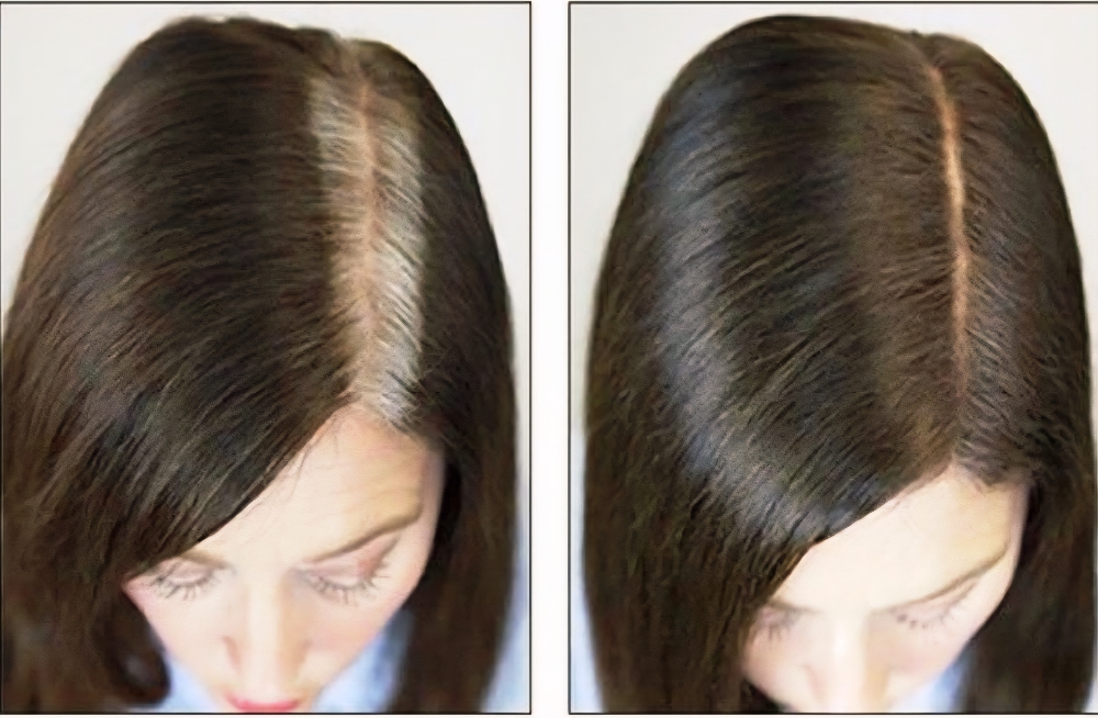 Root Retouch at HaskgalHairDesigns at 49 Mussey Rd Scarborough Maine in Scarborough, ME