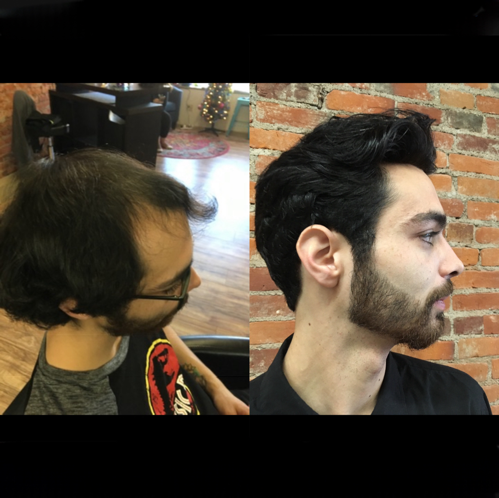 Hair Replacement Consult/Deposit