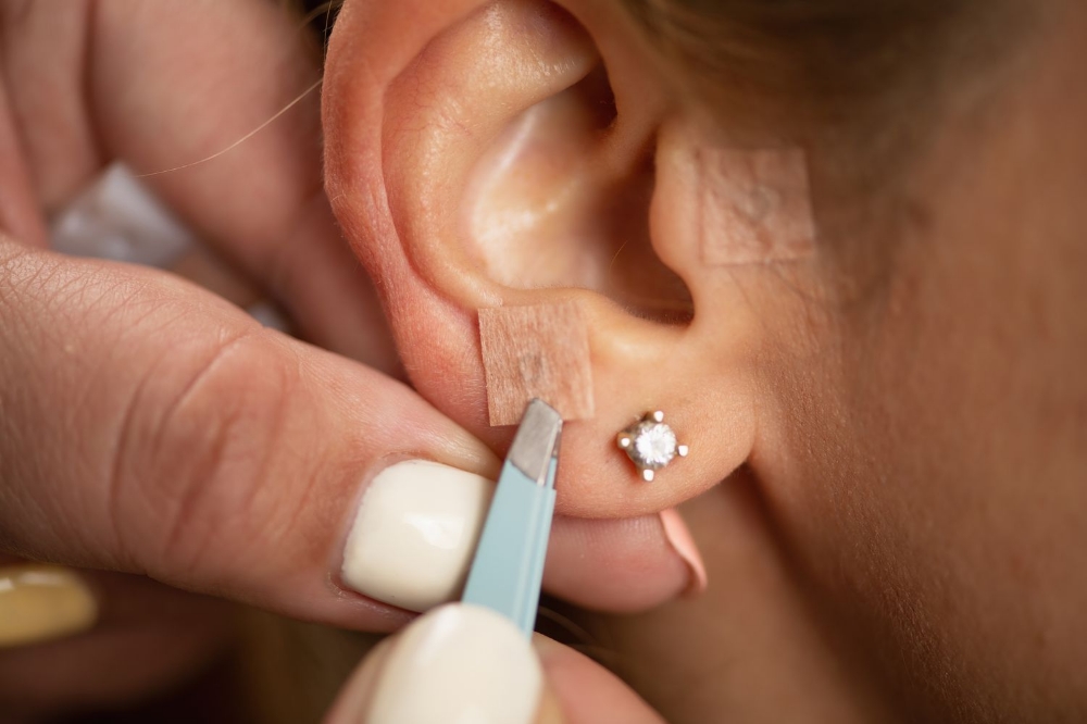 Ear Seeding- Auricular Accupressure