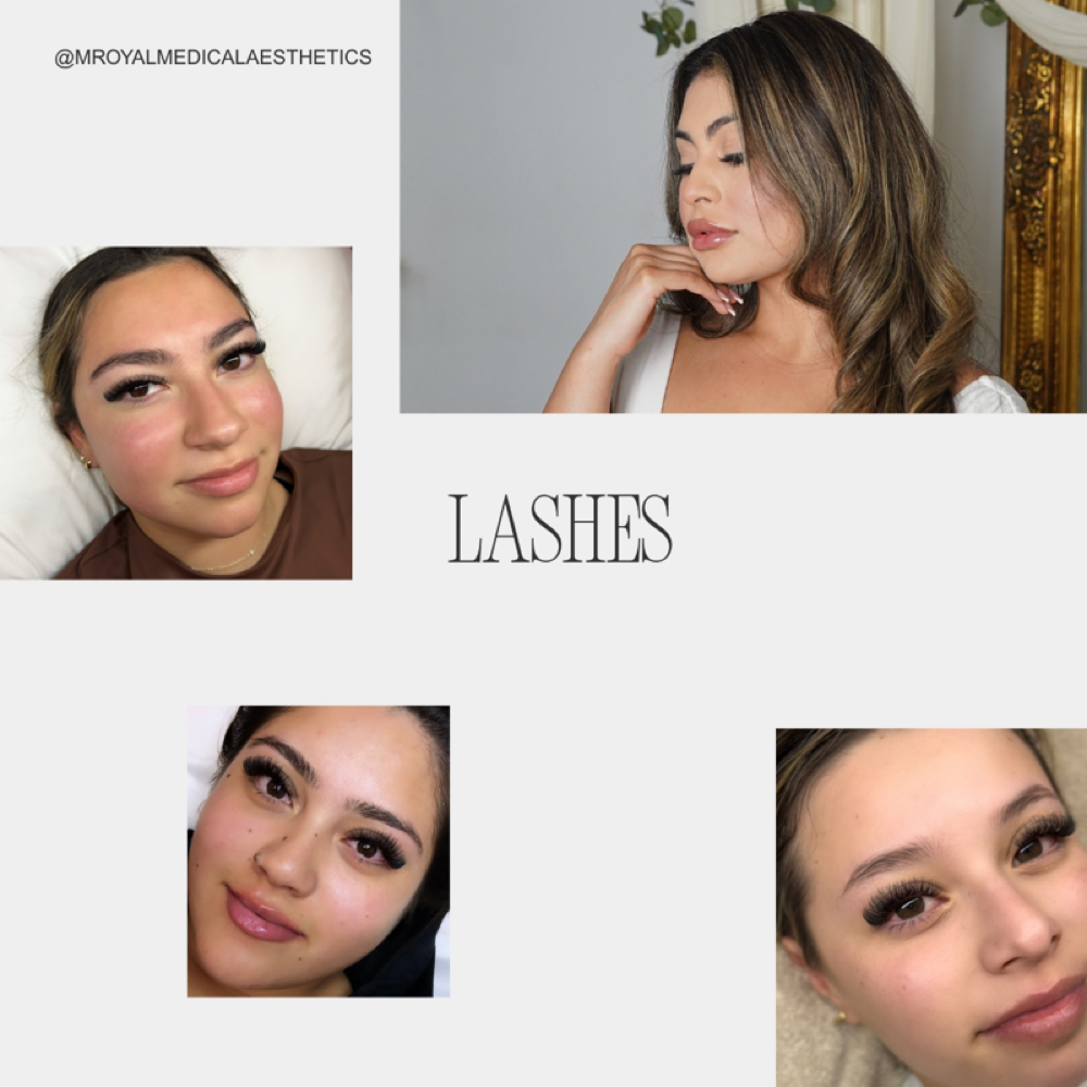 Limited / Exclusive Lashes at Royal Medical Aesthetics in Houston, TX