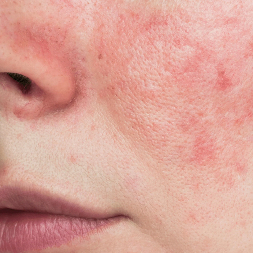 Rescue & Repair Facial at SoLuna Aesthetics in Scottsdale, AZ