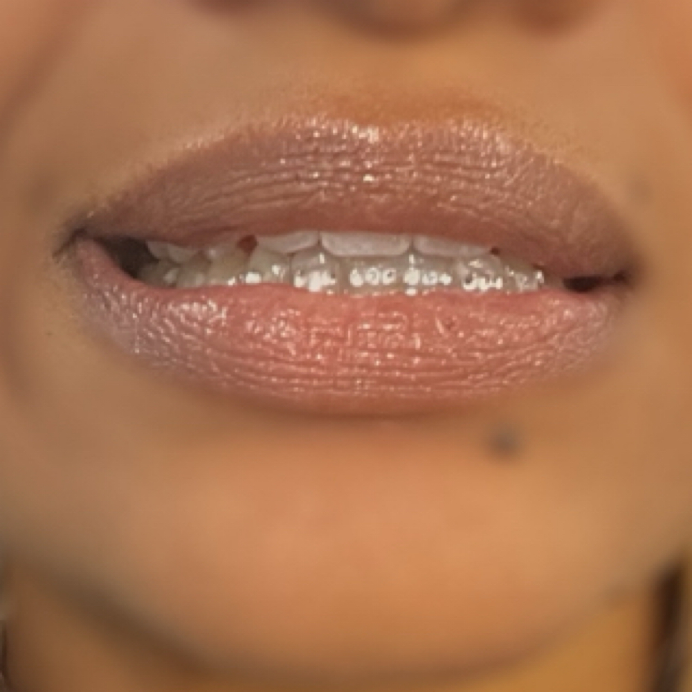 Swarovski Crystals Tooth Gems