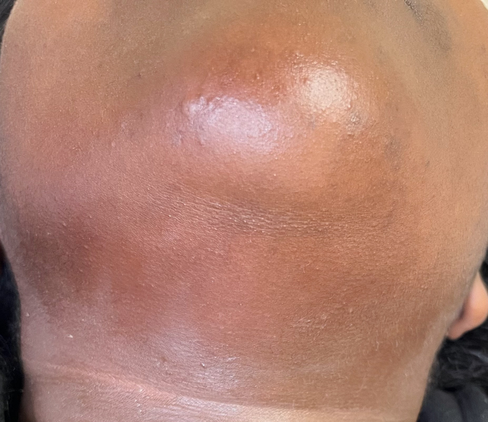 Chin Wax