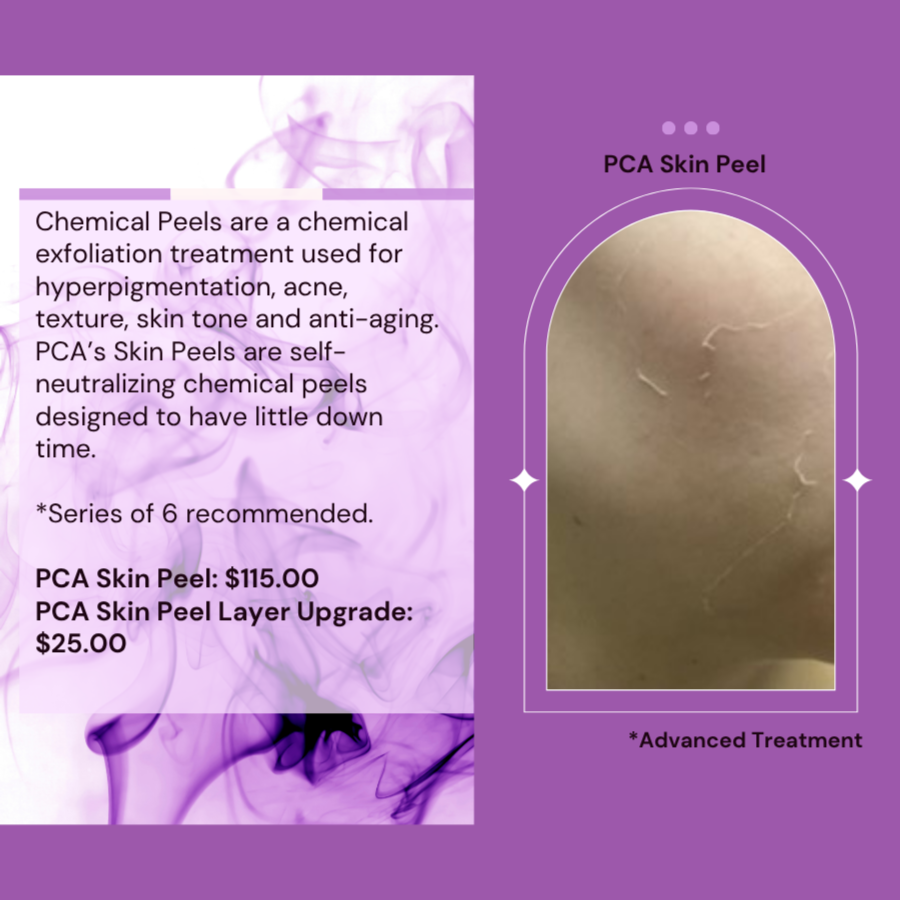 PCA Skin Peel at T.L.C. Skin Esthetics Studio in Brookfield, WI