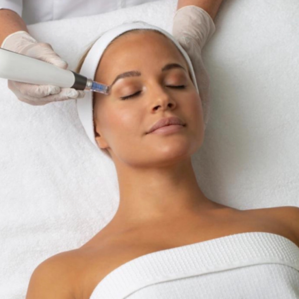 RF Microneedling — Face + Neck at Sunshine Esthetics Lounge in Lake Mary, FL