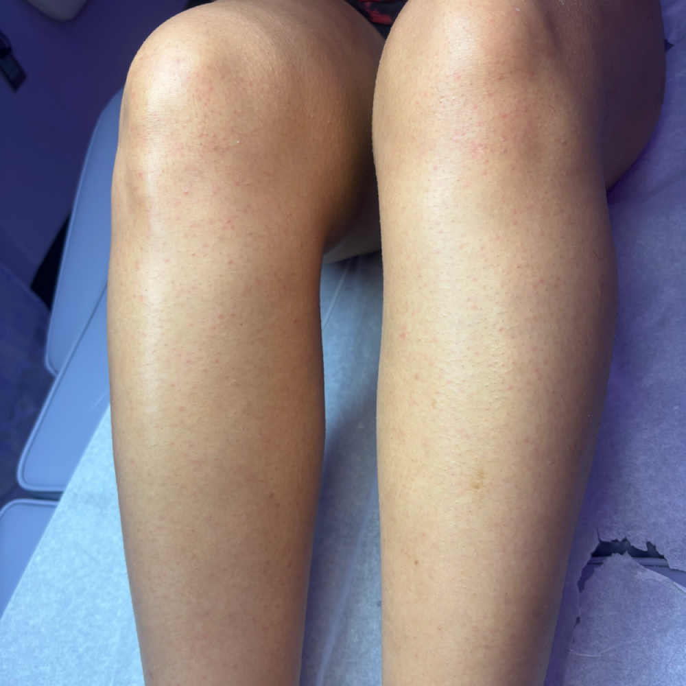 Legs (LOWER) at Wax N Glow LLC in Raleigh, NC