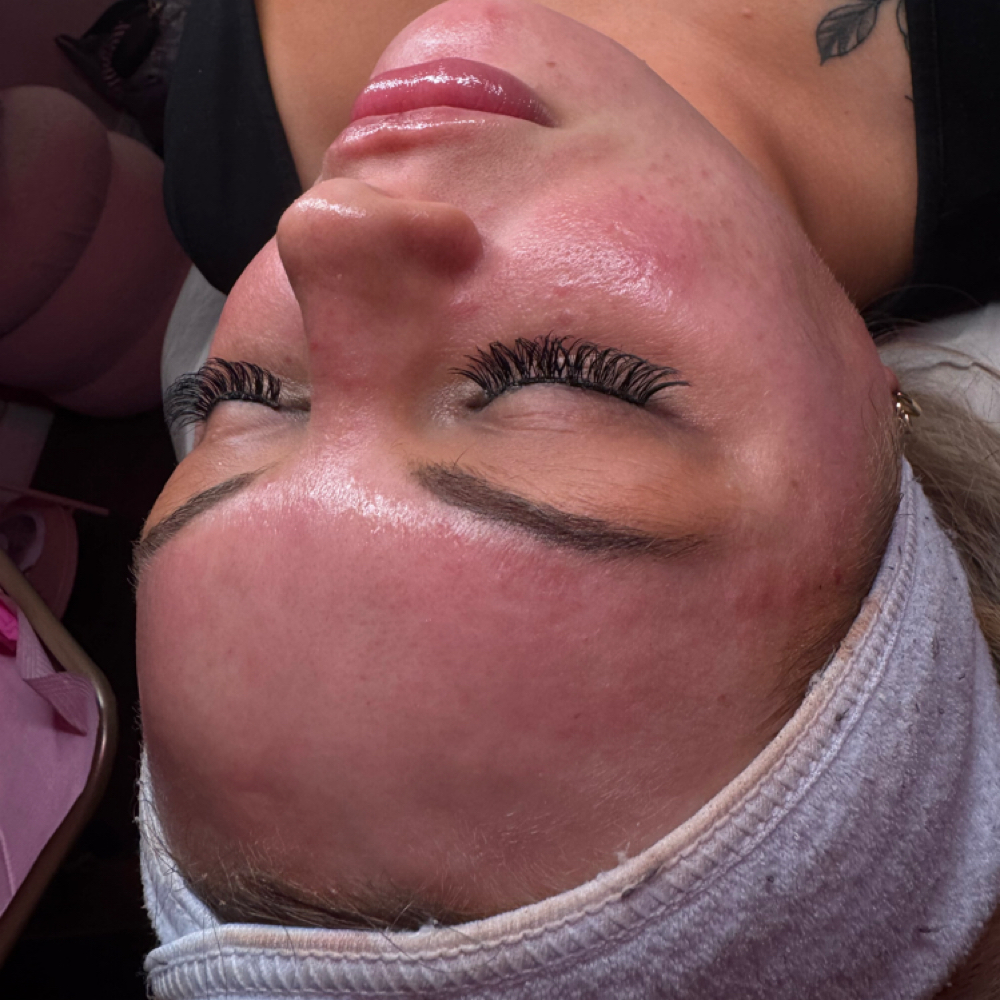 HydraFacial at Glam by K in Logan, WV