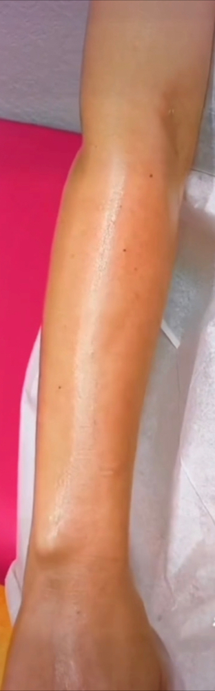 Half Arm
