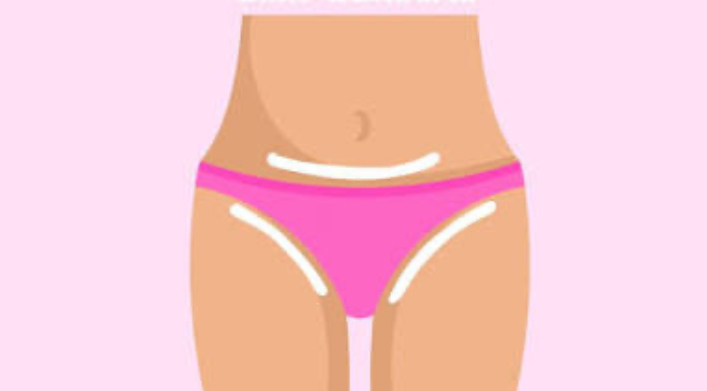 Bikini Line Wax at Royal Glow Experience LLC in Houston, TX