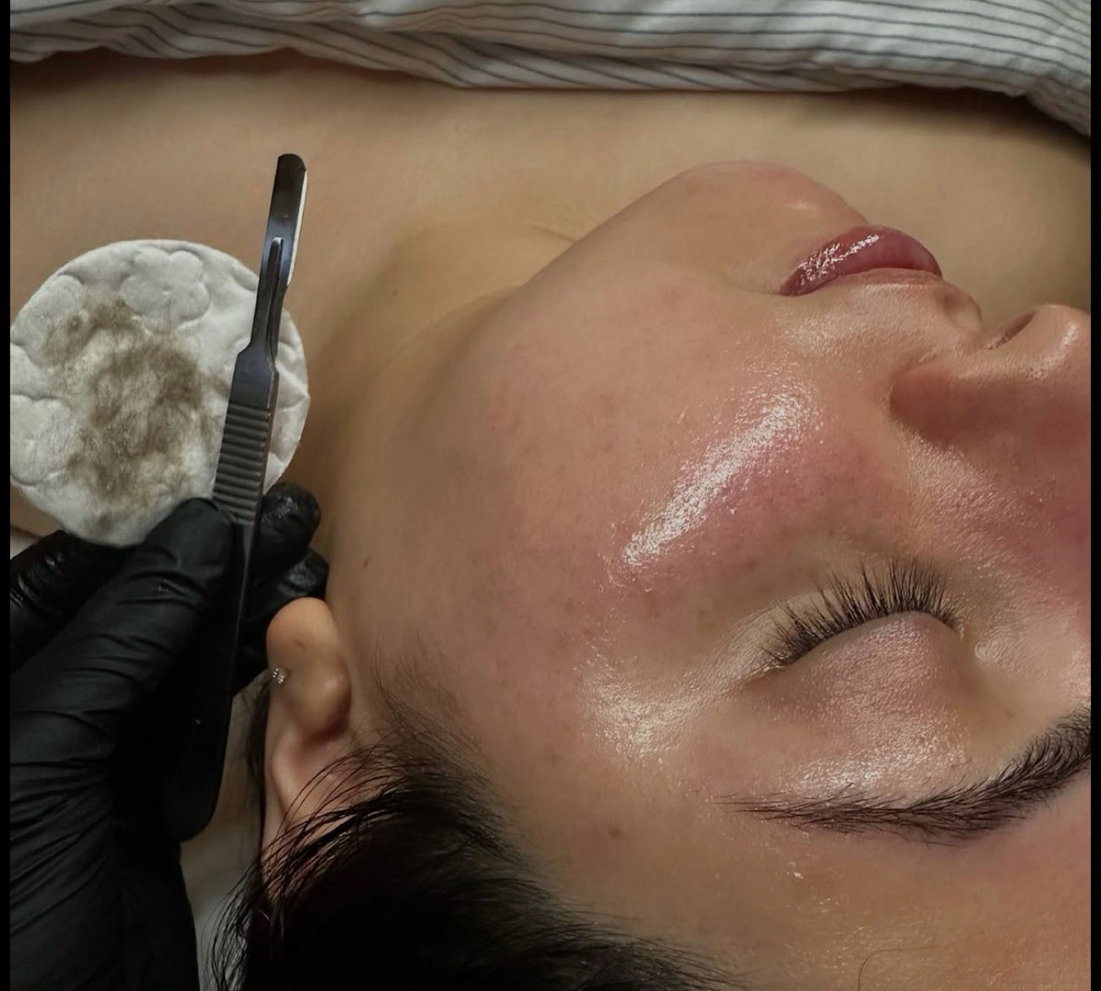 ✨Skinbyizabella Reset Package at SkinByIzabella in Toledo, OH
