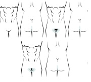 Waxing- Manzilian