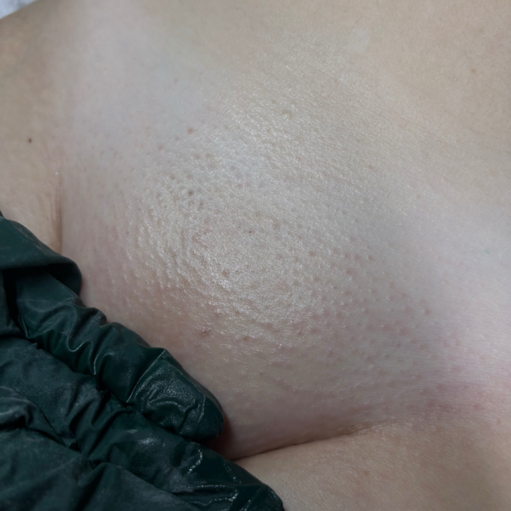 BESTIE Brazilian Wax at Nouvèl Beauty Collective in New London, CT