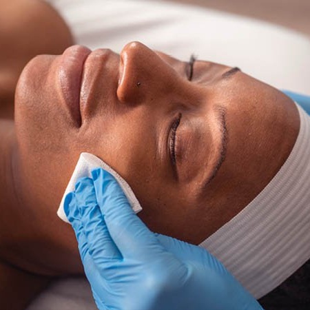 Custom Chemical Peel Facial at Fresh Bloom Esthetics in Kalispell, MT