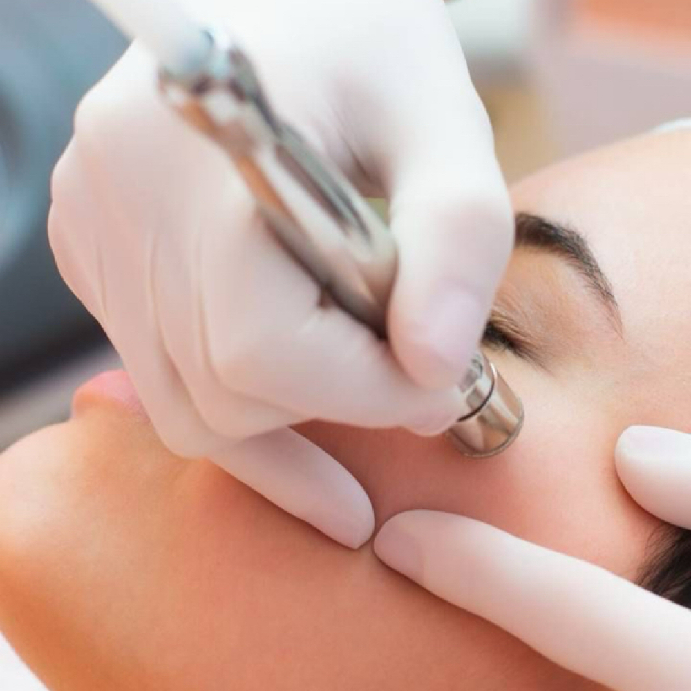 Diamond Glow Dermabrasion Facial at Dew Drop Aesthetics LLC in Fort Smith, AR