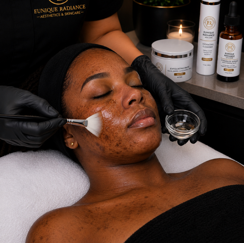 Acne Peel at Eunique Radiance Aesthetics & Skincare in Marietta, GA