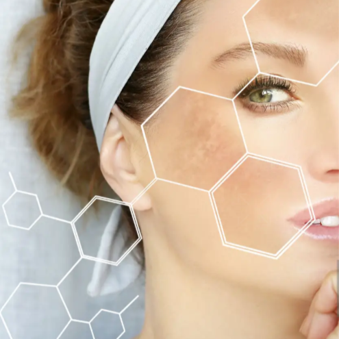 SI Peel at Sophiesticated Esthetics in Miami, FL