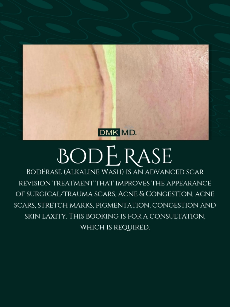 BodErase Consultation