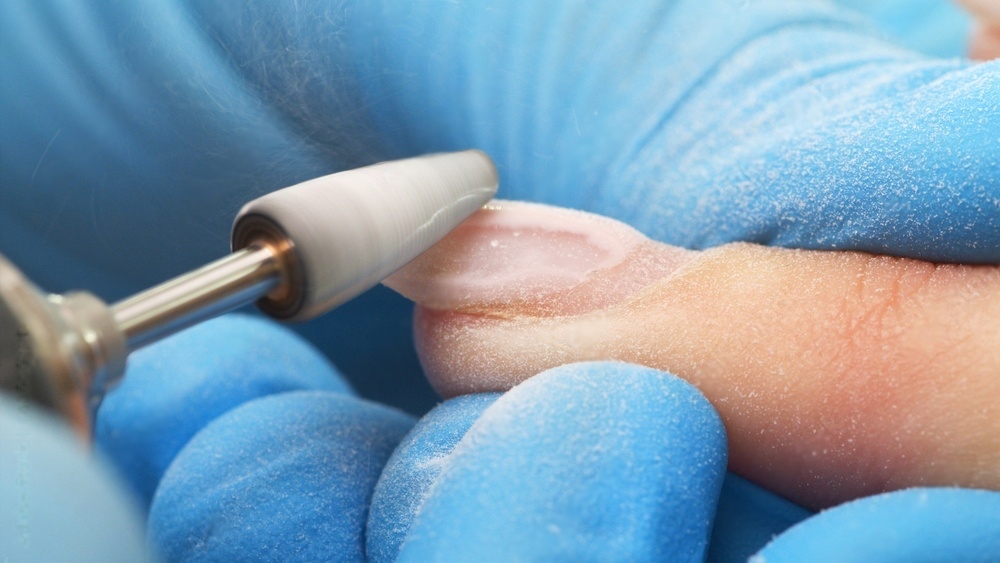Acrylic Removal