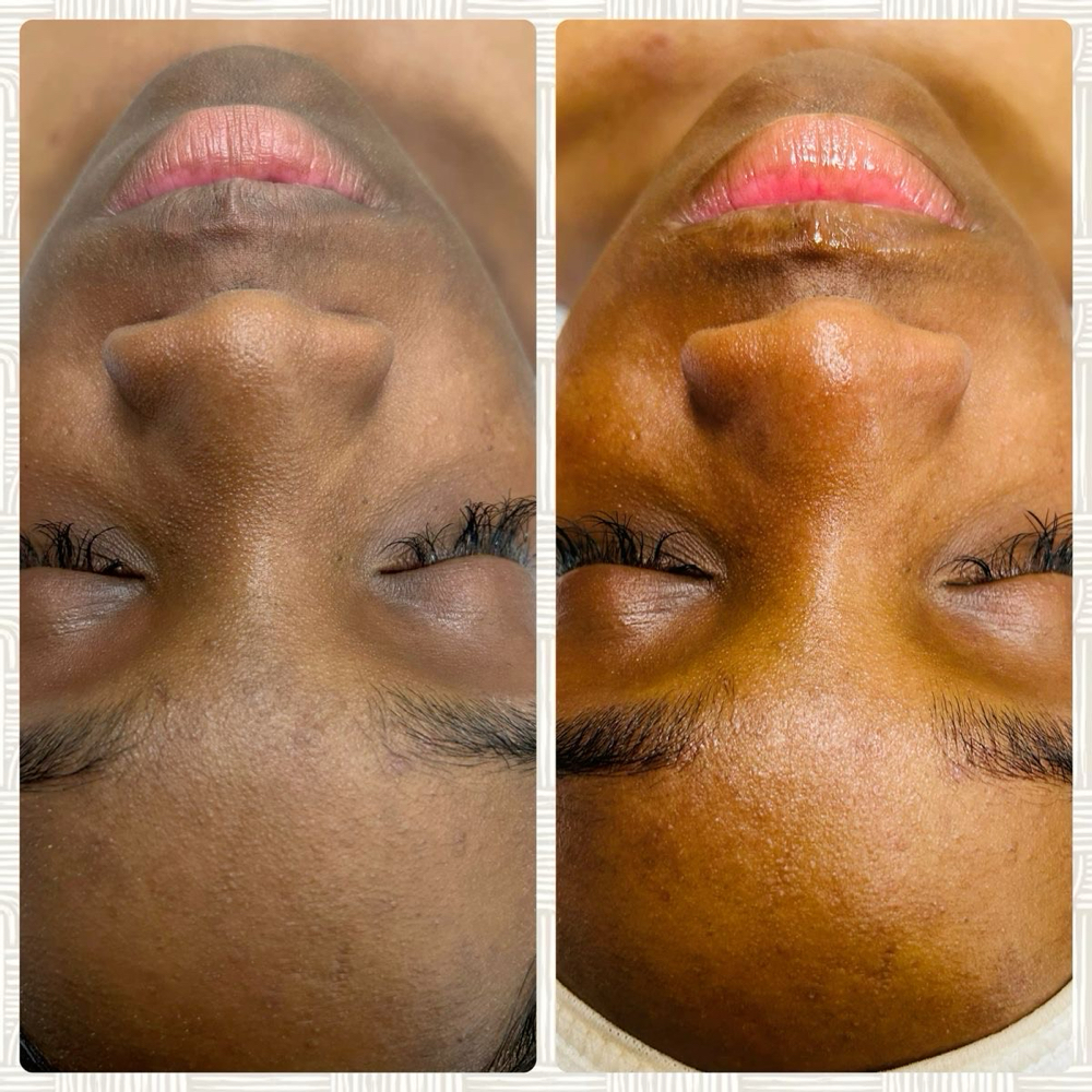 Papaya Turmeric & Kojic Acid