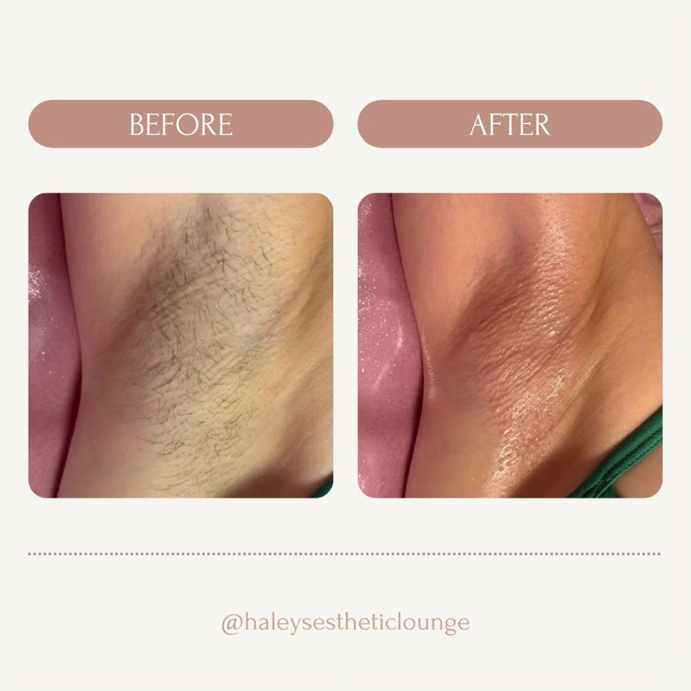 Underarm Wax