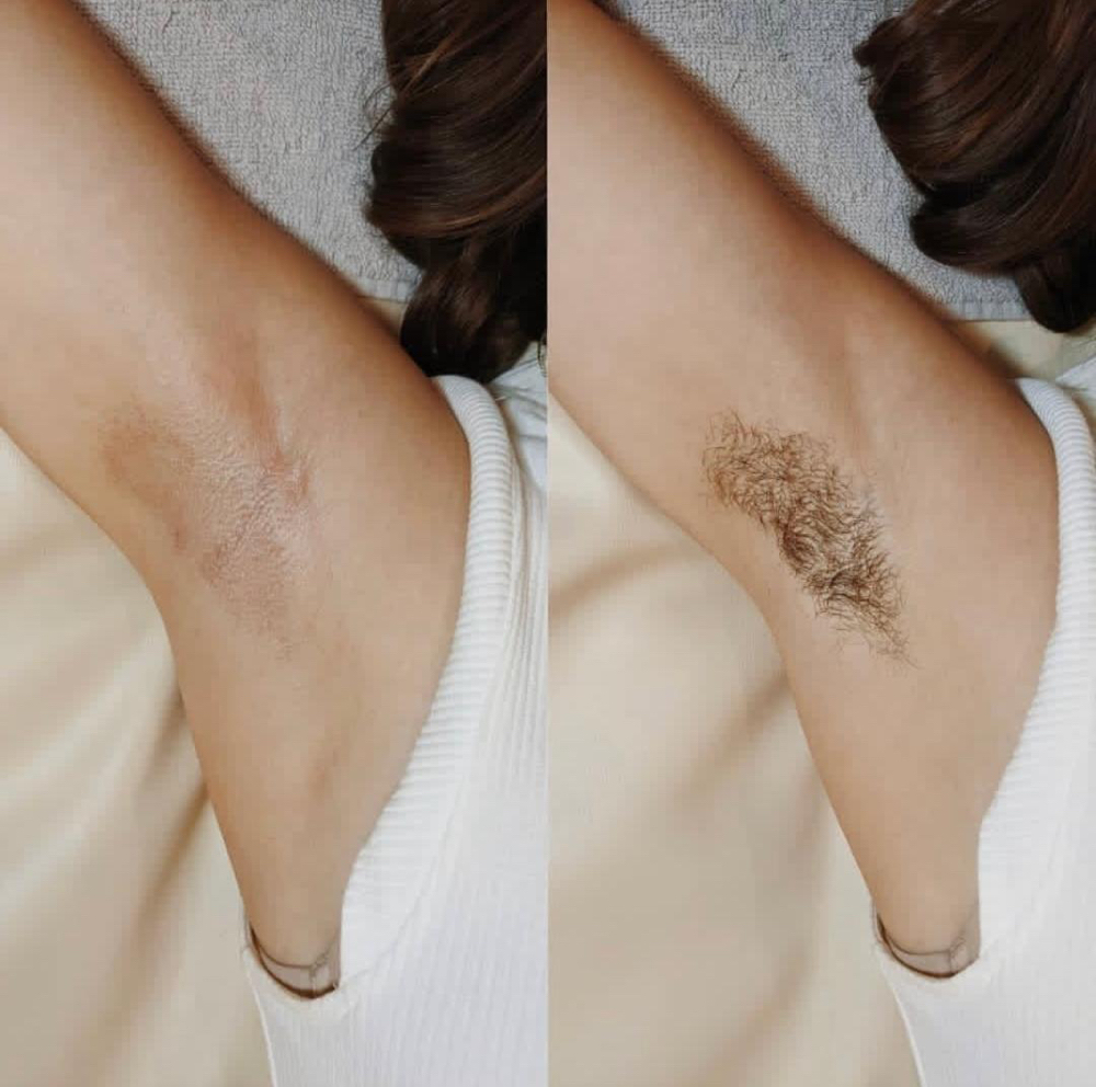 UNDERARMS