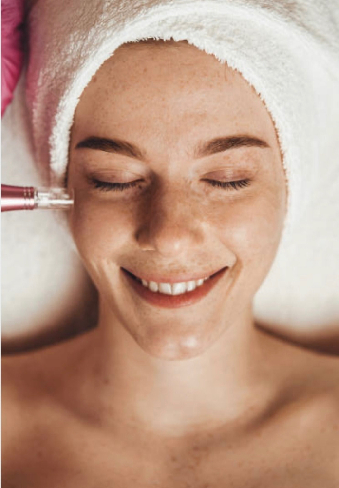 Microneedling