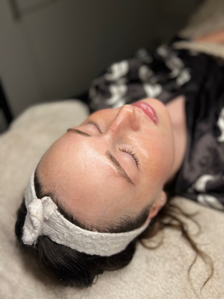 Dermaplane+Rosacea Control Protocol