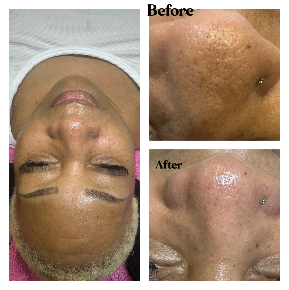 Chrissys Den Hydrating Facial