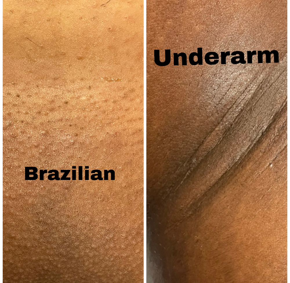 Brazilian/Underarm/Butt&Stmch Strip