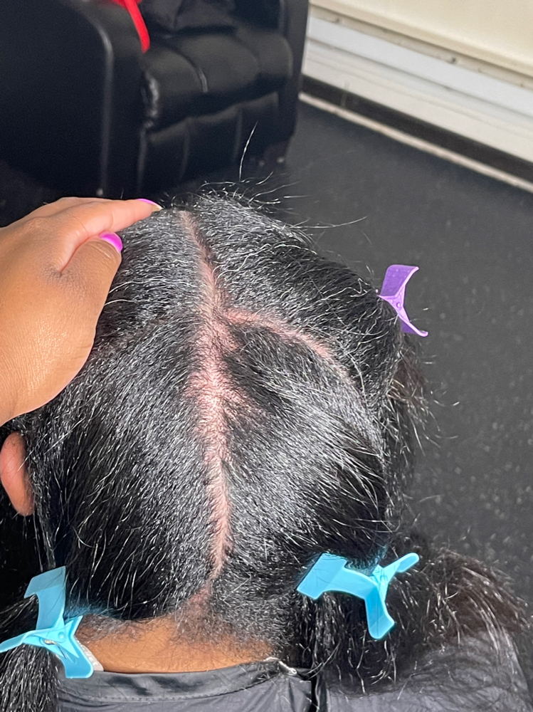 Scalp  Rejuvenation 🫶🏾