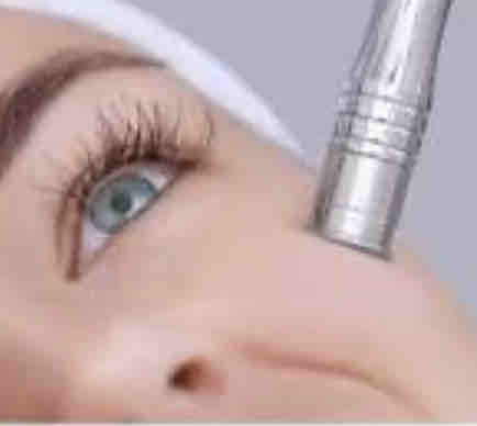 Microdermabrasion Facial