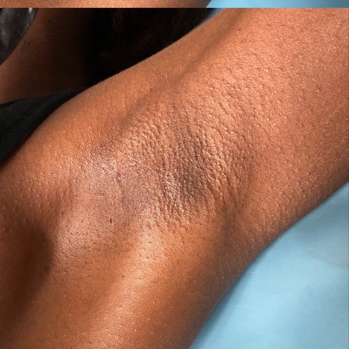 Underarm Hair Removal at Crown Of Essence Hair Studio in COLUMBUS, GA