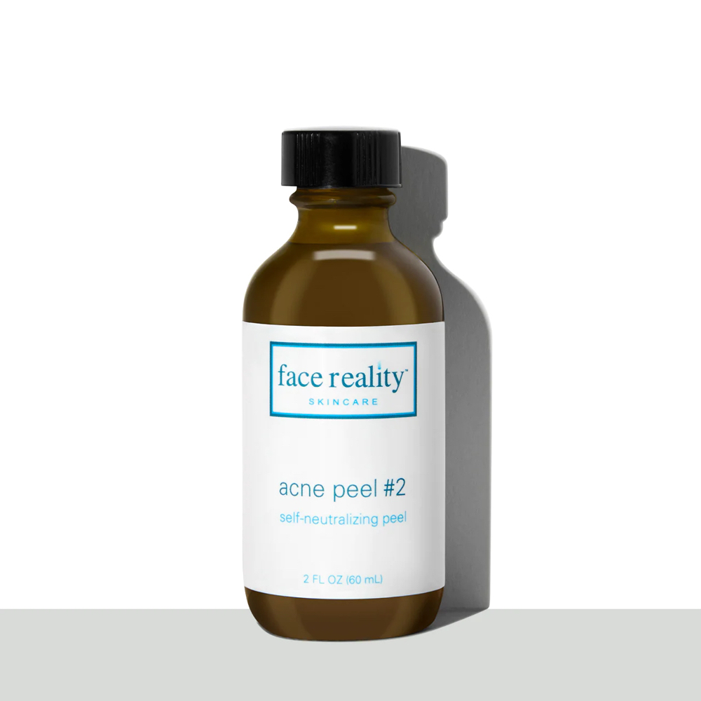 Acne Peel