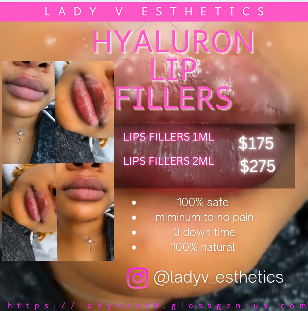 Hyaluron Pen Lip Fillers-2 Syringes