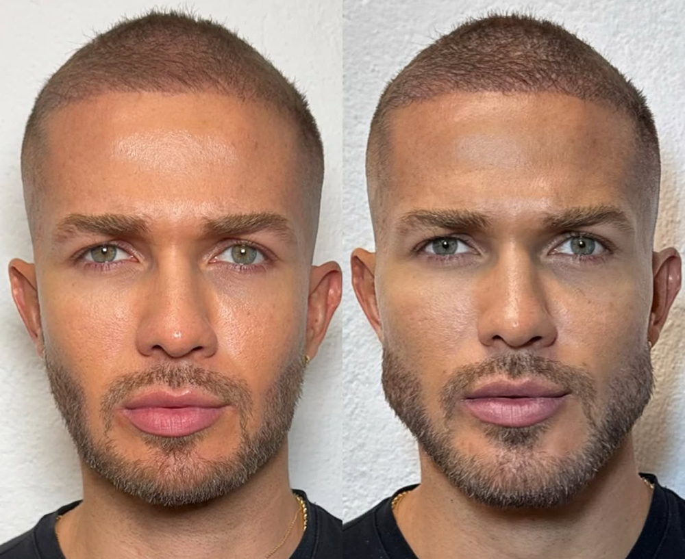 Diamond Face at Kelly Sorza Beauty Esthetic in San Jose, CA