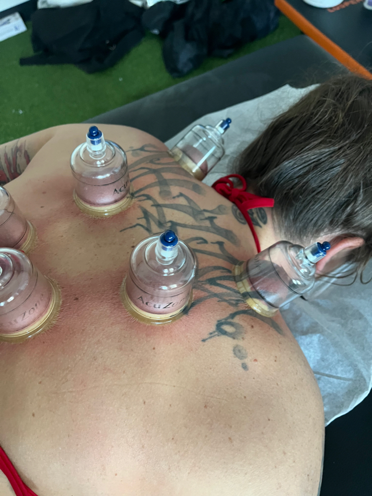 Cupping/Scrapping