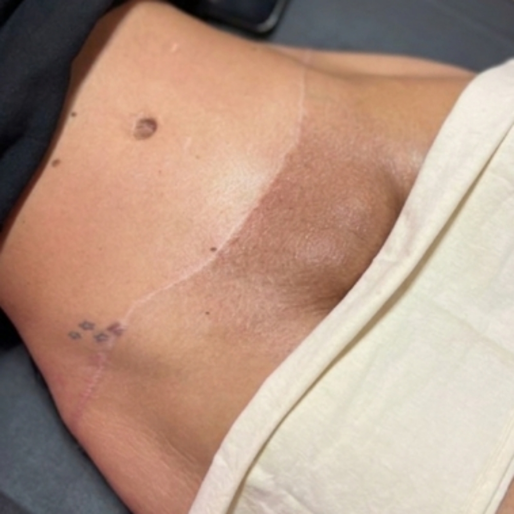 New Client Brazilian Wax (M/F) at Snatched Wax & Beauty in Morristown, TN