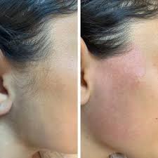 Waxing - Side-Burns