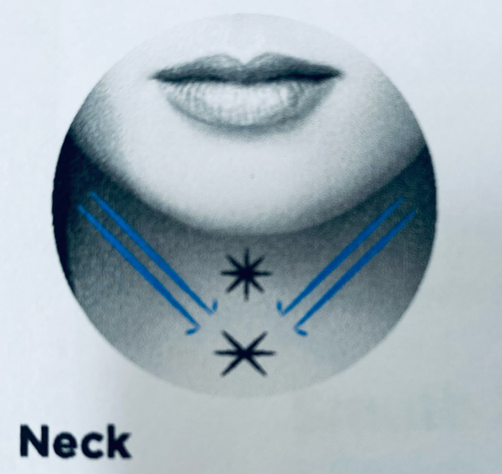 PDO Thread Neck Lift