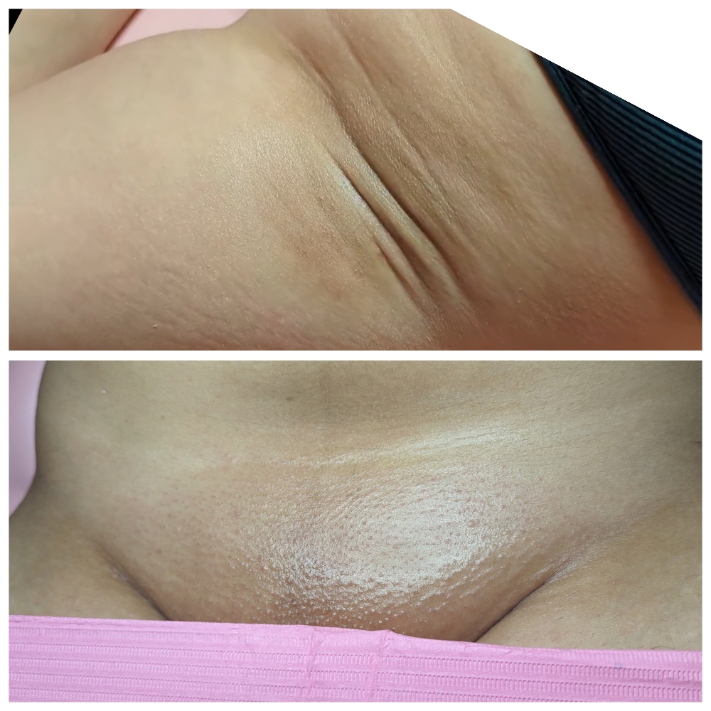 Brazilian + Underarm Wax