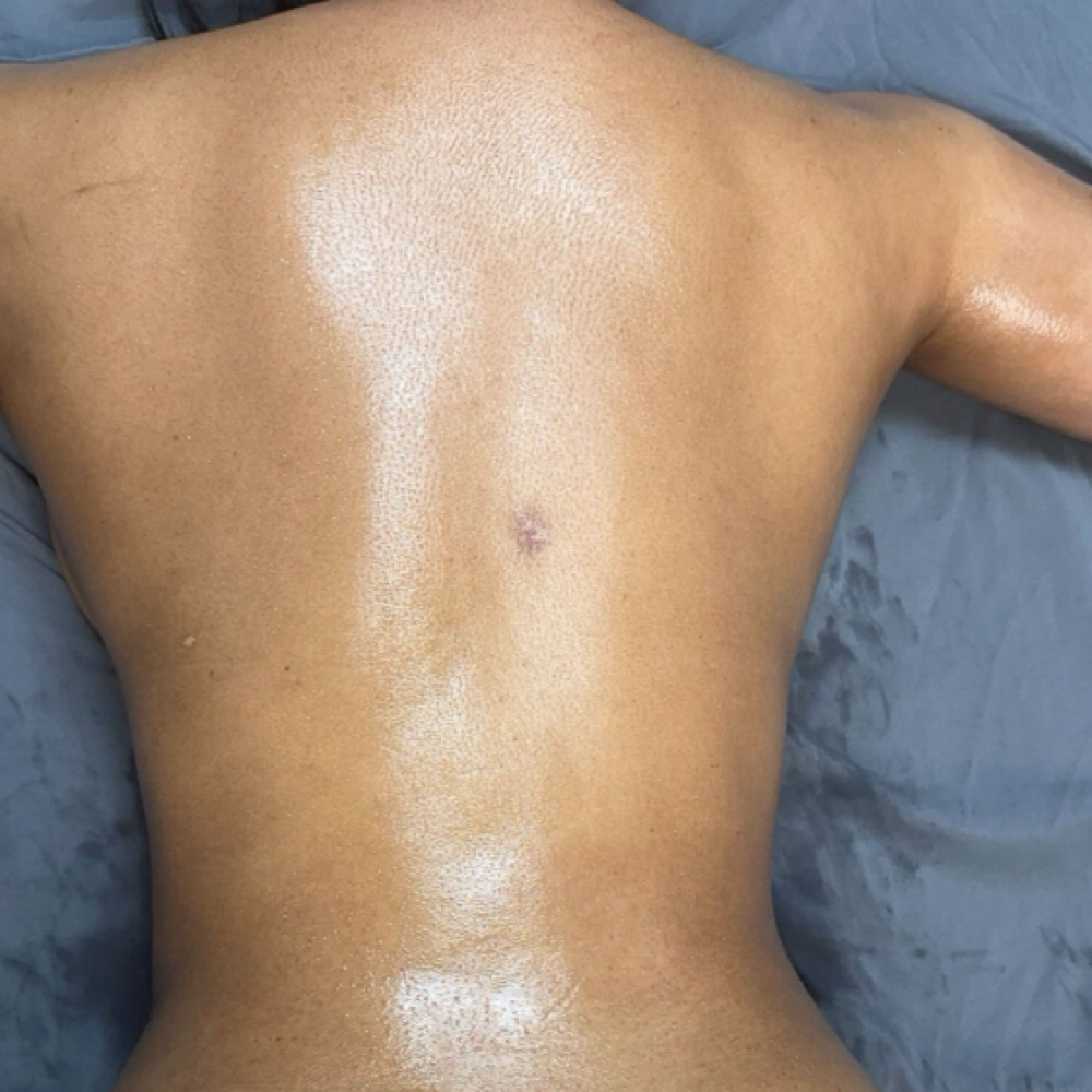Back Facial at N'Vestd Aesthetics in Fairfeild, OH