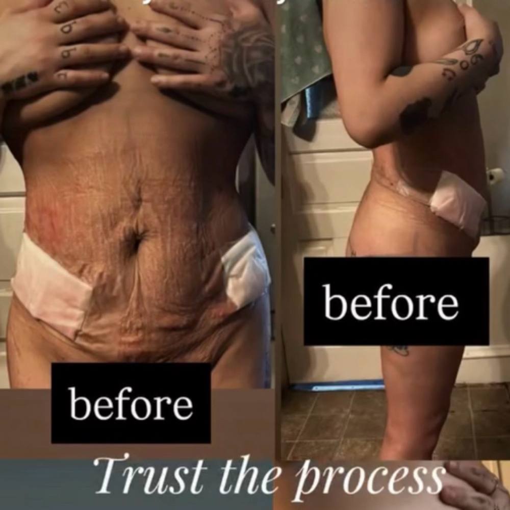 Lymphatic Massage Package (10) at The Beauty Studio by Mia’Love in Allentown, PA