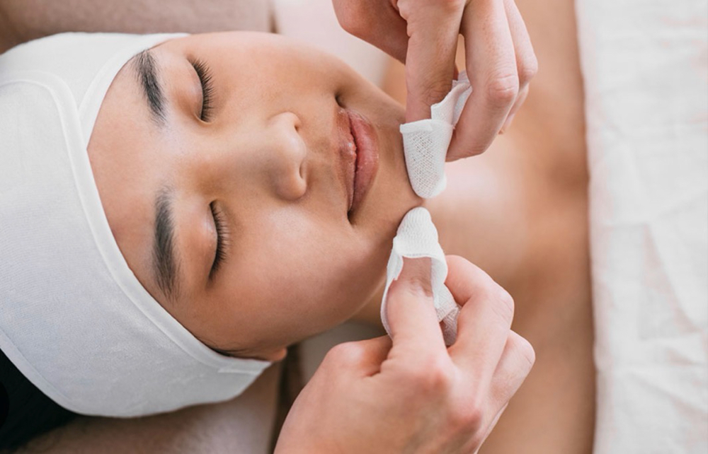Acne Facial